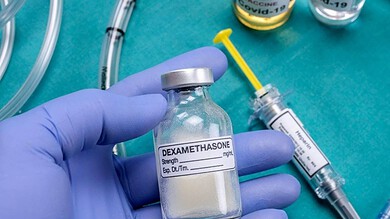 ديكساميثازون