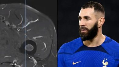 Benzema