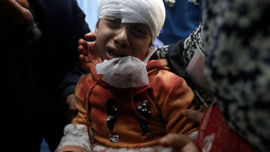 طفلة فلسطينية مصابة من القصف الإسرائيلي