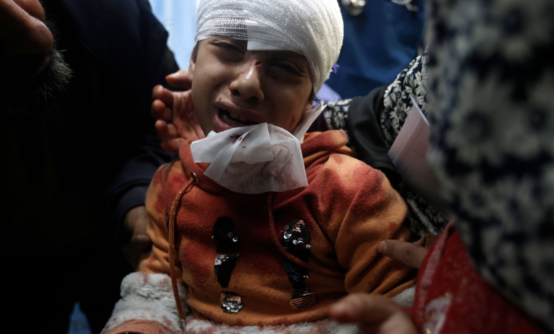 طفلة فلسطينية مصابة من القصف الإسرائيلي