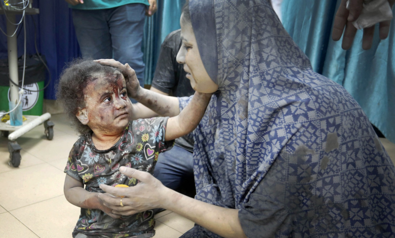 أم وطفلتها في مستشفى الأقصى في دير البلح بغزة بعد قصف مكثف من الجيش الإسرائيلي على قطاع غزة. 3 نوفمبر 2023