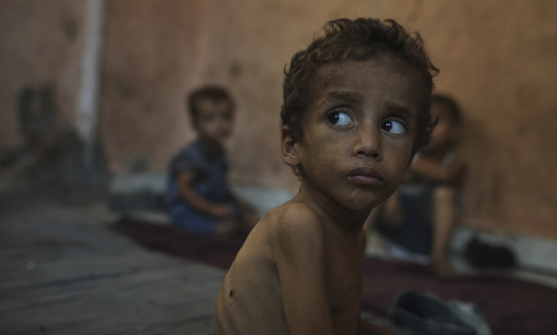 الصحة العالمية: وفيات الجوع بلغت ذروتها في غزة خلال شهر يوليو